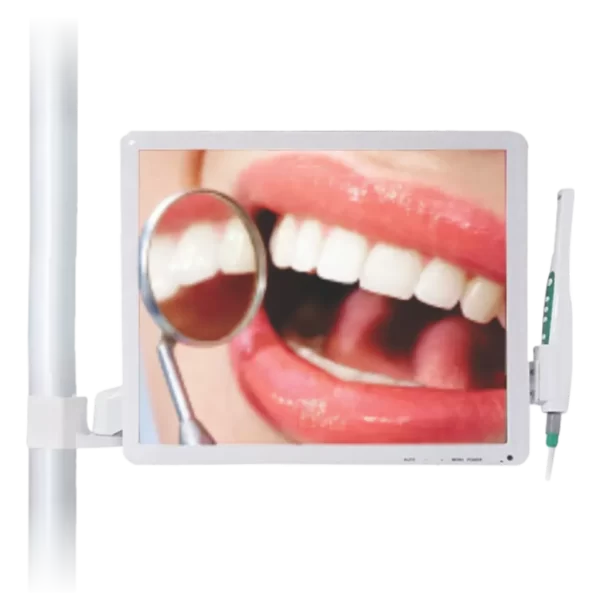 Cámara Intraoral (monitor 17″)